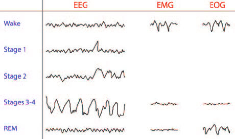 EEG, EMG and EOG readouts during wake and sleep