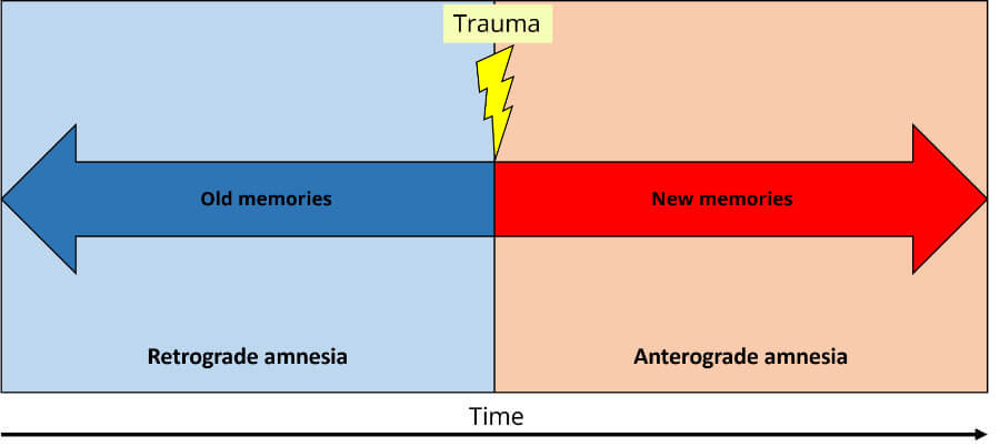 anterograde amnesia vs retrograde amnesia