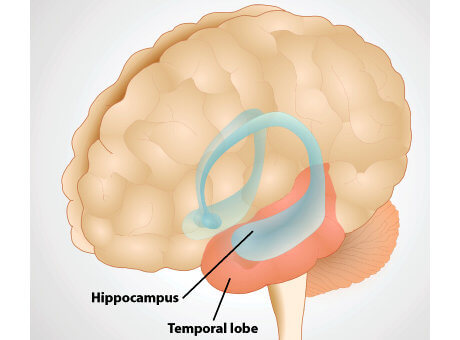 Location of the hippocampus within the temporal lobe